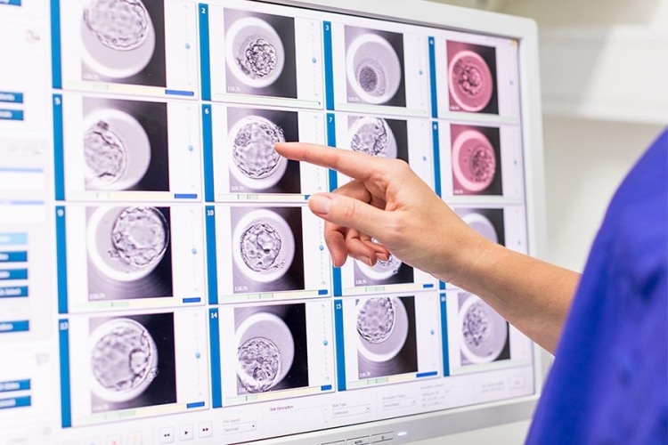 How Does Adore’s Embryoscope Improve IVF Outcomes?